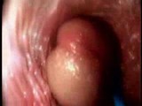 Video from the inside of a vagina... very interesting